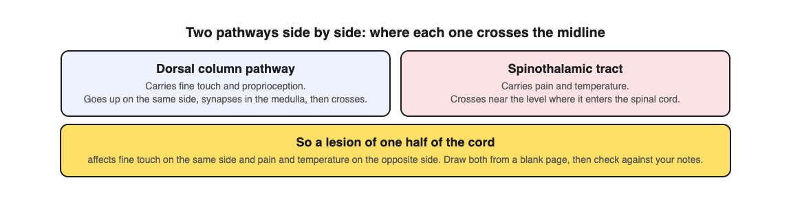 Diagram comparing the dorsal column pathway, which crosses in the medulla, with the spinothalamic tract, which crosses near its level of entry, and the effect of a lesion of one half of the cord